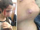 Дочери уроженки Молдовы, зверски убившие отца-насильника, показали фото последствий издевательств над ними