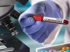 Минздрав расширил круг лиц, которые могут пройти тест на коронавирус бесплатно  