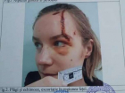 Пострадавшая в ДТП в такси девушка обратилась в суд