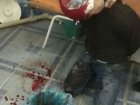 Окровавленный мужчина напал на медиков одесской скорой помощи и попал на видео