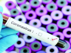 Срочно! В Молдове подтверждены два новых случая коронавируса – число заболевших достигло восьми
