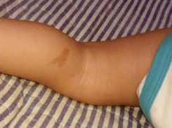 Молдаванка родила в Италии ребенка с картой нашей страны на ноге