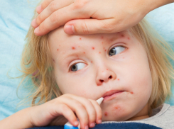 В связи со вспышкой кори в Румынии граждан Молдовы призывают вакцинироваться