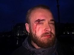 Кровавое избиение вернувшегося из Донбасса военнослужащего совершили торговцы в Киеве