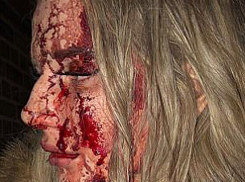 Кровавое избиение сексуальной блондинки совершил пытавшийся пощупать ее ягодицы мужчина в ночном клубе 