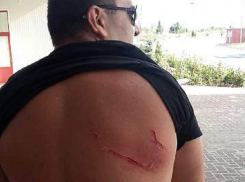 Мужчина и девушка из Молдовы пострадали от рухнувшей крыши румынской таможни