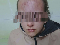 Минобразования отреагировало на резонансное нападение на школьницу