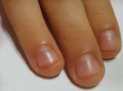 Ногти вместе с мясом и кожей отрезали малышам в детском саду Кишинева