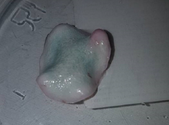 Беременной женщине пришлось съесть опасный йогурт со слизью из столичного супермаркета