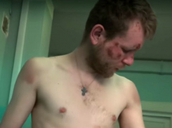 «Очень больно»: украинский депутат избил и связал цепью жителя Донбасса