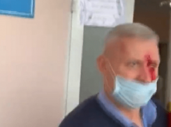 В результате избиения у примара Кирсово обнаружили сотрясение мозга