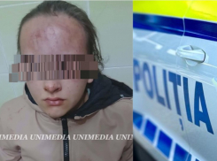 В Яловенском районе 13-летняя девочка была избита малолетками: возбуждено уголовное дело