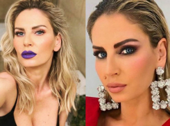 Красавице-певице пришлось уничтожить «знак при рождении» на своем лице по медицинской причине