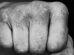 18+ «Дай палку, я ее убью!» - в Бачой подростки жестоко избили девушку