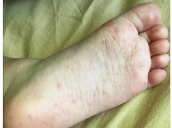 Жуткий вирус подхватил ребенок из Молдовы на популярном турецком пляже