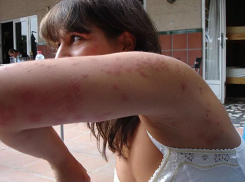 Нашествие блох и комаров обрушилось на жителей Кишинева из-за аномальной жары 