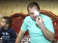 Украинка ударом ноги выбила глаз защитившему ее от любовника полицейскому