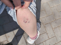 Нападение стаи бродячих собак в Вадул-луй-Водэ: женщина с ребенком теперь проходит вакцинацию