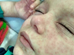 Разъяренные мамы заболевших корью украинских детей атаковали известный цирк