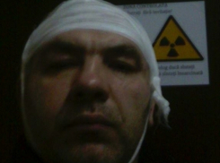 Надевший на осла полицейскую форму активист пострадал от пробравшегося в дом вора 