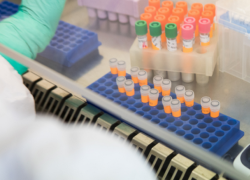 Новый случай оспы обезьян в Молдове – его завезли из Парижа 