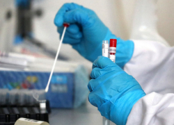 В Молдове выявлено 389 новых случаев COVID-19