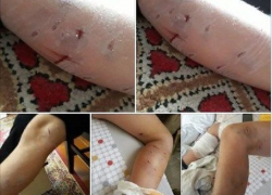 Стая бродячих собак порвала 7-летнего мальчика в центре Дрокии