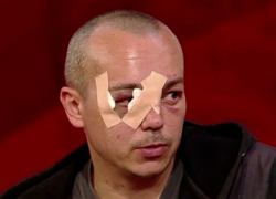 Один из пострадавших пассажиров троллейбуса рассказал об аварии на Алба-Юлия