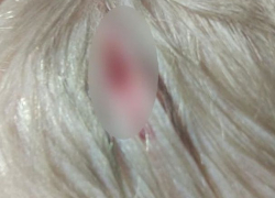 В Теленештах ребенок получил серьезную травму в детском саду: что говорят воспитатель и полиция