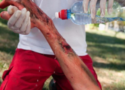 От отравления газом в Тараклии погибла женщина, а в Криулянах взрыв баллона изуродовал парня 