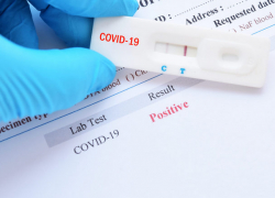 За неделю в Молдове - 1 101 новый случай заражения ковидом