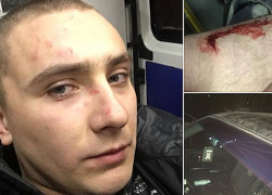 Кровавую расправу над известным националистом, срывавшим концерты российских артистов, совершили в Одессе