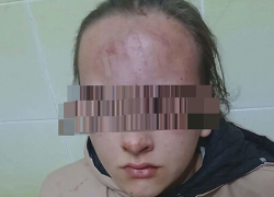 Избиение школьницы в Яловенском районе: виновным грозит реальный срок