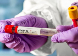 В Молдове выявлено 329 новых случаев COVID-19