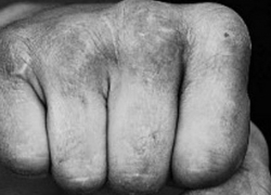 18+ «Дай палку, я ее убью!» - в Бачой подростки жестоко избили девушку