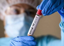 В среду в Молдове подтвердились еще 734 новых случая COVID-19 