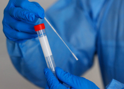 В Молдове выявлено 712 новых случаев COVID-19 