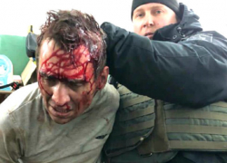 «Блестящая спецоперация»: окровавленный террорист задержан, все харьковские заложники освобождены