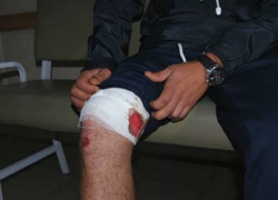 Случайным выстрелом ранил в ногу приятеля житель Каушанского района