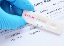 ПЦР-тесты за 300 лей доступны в Молдове