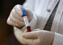 +241 заболевший за сутки: в Молдове резко выросло число новых случаев COVID-19 