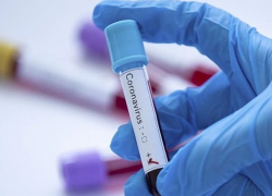 В Молдове выявлено 456 новых случаев COVID-19 