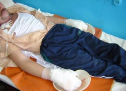 Мужчину с обмороженными руками и ногами чудом спасли на пороге собственного дома в Шолданештах 