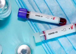 В Молдове +862 новых случаев заражения COVID-19 за сутки