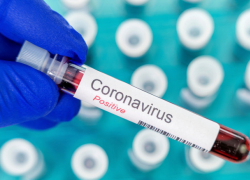  329 новых случаев ковида выявлены в Молдове