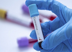 В понедельник в Молдове подтвердилось 143 новых случая COVID-19 