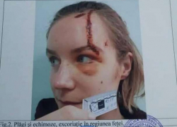 Пострадавшая в ДТП в такси девушка обратилась в суд