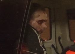 Грабитель тяжело поранил сам себя в подземном переходе Кишинева