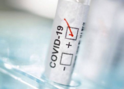 +152 новых случая COVID-19 за пятницу – ситуация в Молдове 