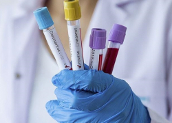 В понедельник в Молдове выявлено 304 новых случаев COVID-19 